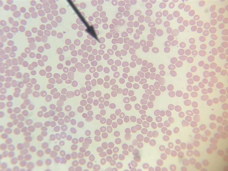 <p>In the image above, identify the formed element at the tip of the pointer.</p>