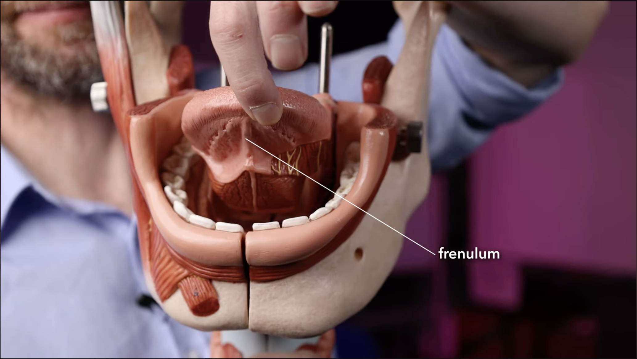 <p>The flap of skin anchoring the tongue to the floor of the oral cavity</p>
