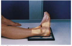 <p>kVp: 60-75</p><p>Grid: No</p><p>CR: directed midway between malleoli</p><p>Patient position: Supine, legs fully extended, dorsiflex foot to 80-85° and rotate leg and foot medially 45°</p><p>Evaluation criteria: Distal tibiofibular joint open, Distal ⅓ of tibia and fibula demonstrated, Proximal ½ of metatarsals included</p>