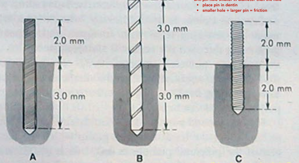 <ol><li><p>cemented</p></li><li><p>friction lock</p></li><li><p>self-threading</p></li></ol><p></p>