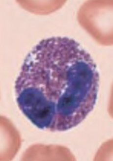 <p>What blood cell is this?</p>