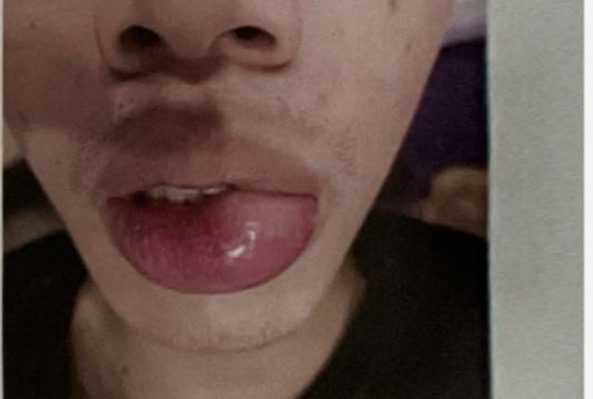 <p>CHẨN ĐOÁN?</p>