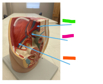 <p>What is the pink arrow?</p>
