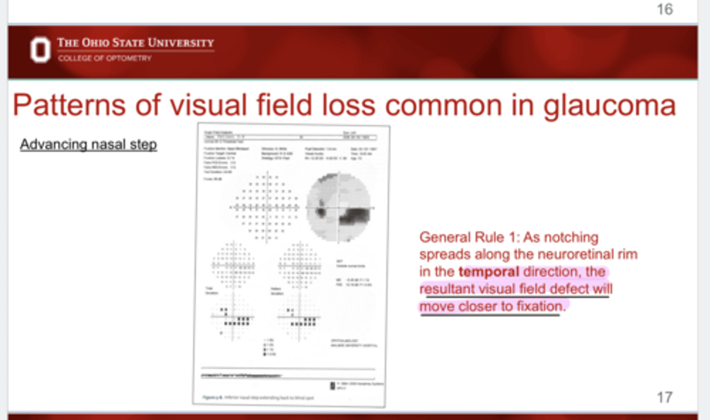 <p>As notching spreads along the neuroretinal rim in the _____ direction, the resultant visual field defect will move closer to fixation</p>