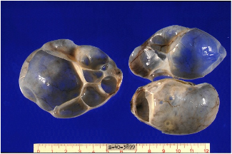 <p>unilocular/bilocular/multilocular; <span>Used to describe cystic structures</span></p>