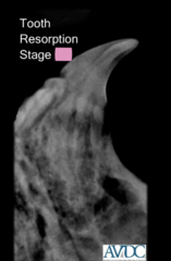 <p>what stage of tooth resorption is this?</p>