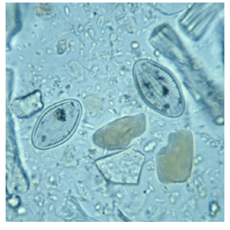 <p>unknown artifacts that look like</p>