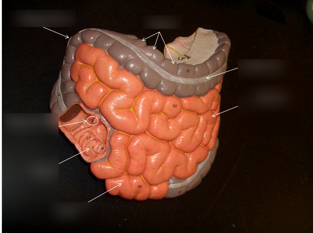 <p>Jejunum?</p>