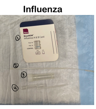 <ul><li><p><strong>Preparation</strong>: Have the patient blow their nose and tilt their head back.</p><p></p></li><li><p></p><p><strong>Collection</strong>: Insert a nasopharyngeal swab, twist, and remove.</p><p></p></li><li><p><strong>Processing</strong>:</p><ul><li><p>Place the swab into the solution and twist.</p><p></p></li><li><p>Pipette the solution onto the test card and close it.</p><p></p></li></ul></li><li><p></p><p><strong>Reading</strong>: Read after 15 minutes.</p><p></p><ul><li><p>A control line must be present.</p><p></p></li><li><p>A positive test is indicated by double lines.</p></li></ul></li></ul><p></p>