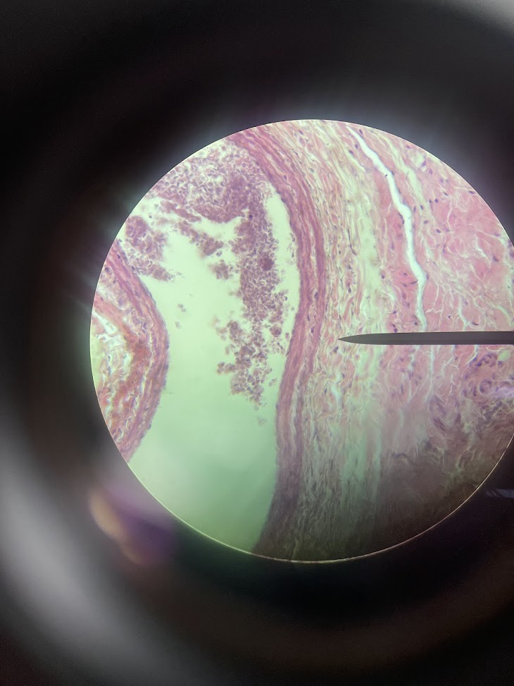 <p>structure name + layer name</p>