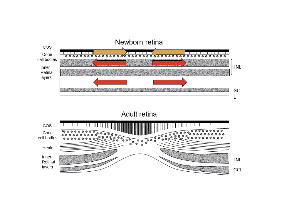 <ul><li><p>Cones are thick (“fat”), not slender</p></li><li><p>Outer segments are very short</p></li><li><p>No fibers of Henle</p></li><li><p>Inner nuclear layer (INL) extends through the central retina</p></li><li><p>Ganglion cell bodies form a single layer throughout</p></li><li><p>The foveal pit is shallow and poorly defined</p></li></ul><p></p>