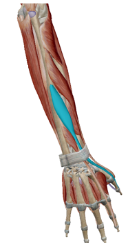 term image