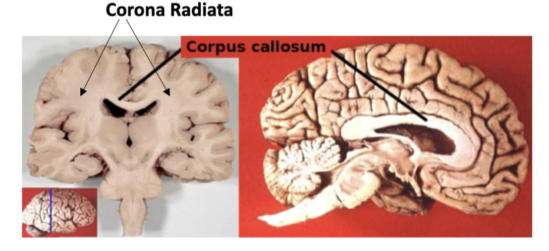 <p>Internal anatomy</p>