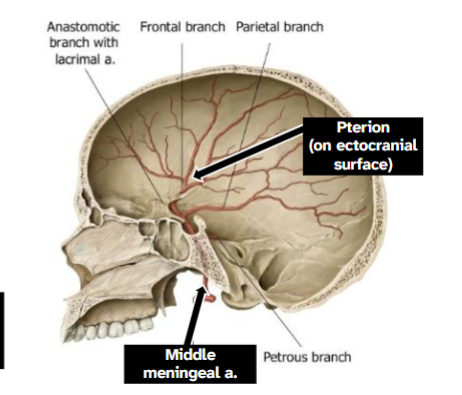 <p>Surrounded by two roots of the auriculotemporal nerve</p><p>Moves through foramen spinosum to middle cranial fossa</p><p>Main blood supply to dura mater</p><p>Passes by pterion</p>
