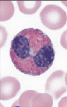 <p>How to identify eosinophils?</p>