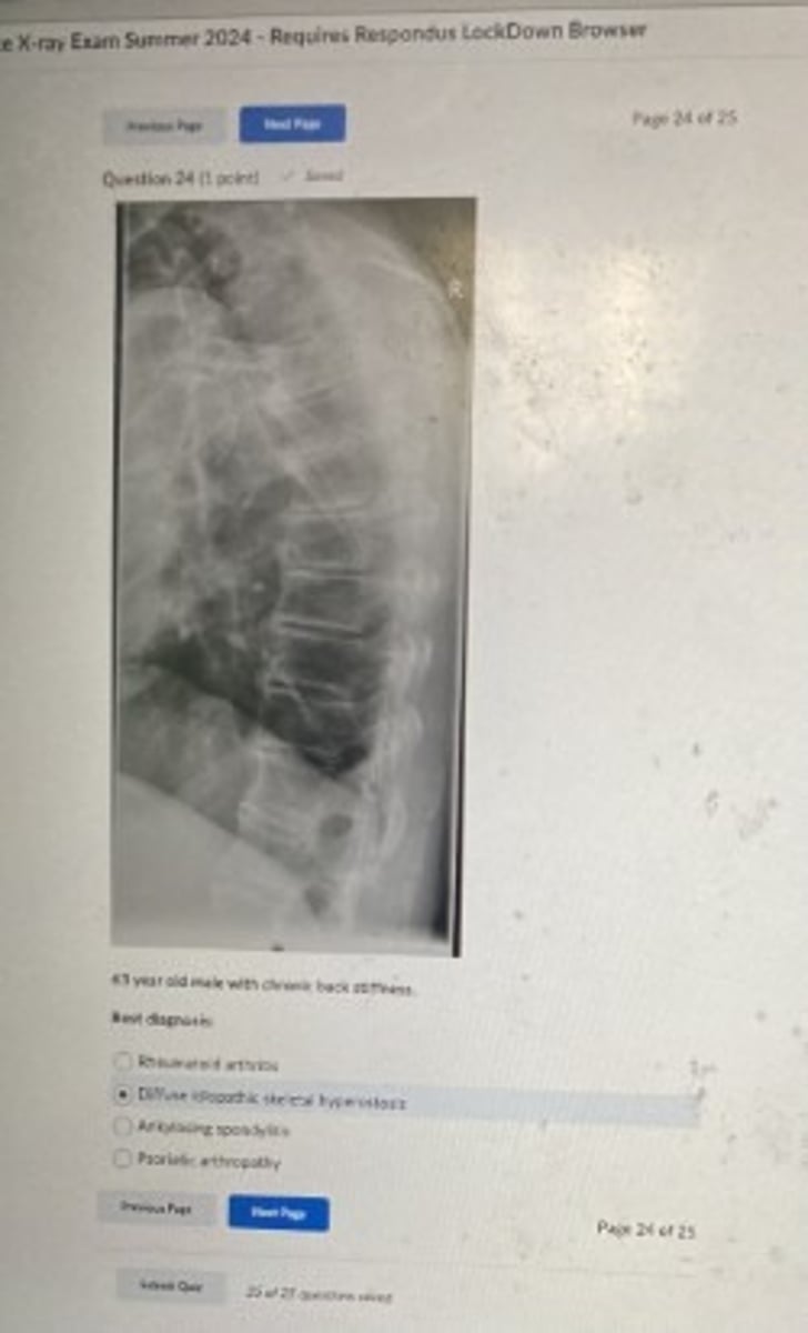 <p>Diffuse idiopathic skeletal hypertrophy</p>