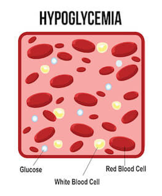<p>Blood glucose levels are too low</p>