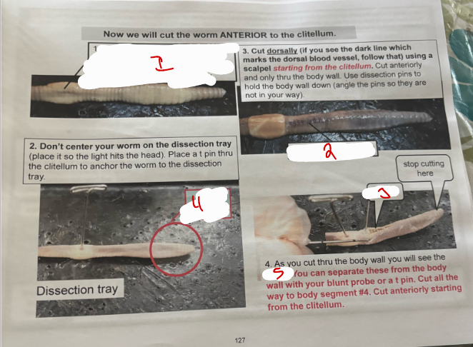 <p>Anterior Cut Earthworm</p>