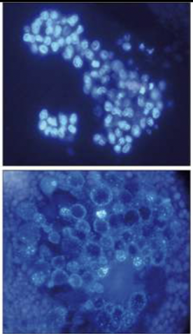 <p>Appear quite different than the original nuclei inside a frog egg. In a normal adult stem cell, small nuclei that are well condensed. As cells differentiate, they start silencing genes they don’t need (epigenetics) and you would have to turn them back on again to go back up the hill → the cytoplasm contains factors to create these.  </p>