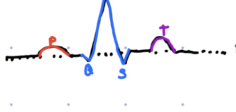 <ul><li><p>Ventricular repolarization, relaxation </p></li></ul><p></p>