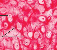 <p>elastic cartilage</p>