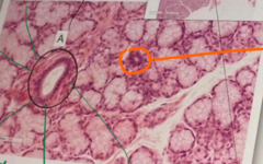 <p>Name the structure at A</p>