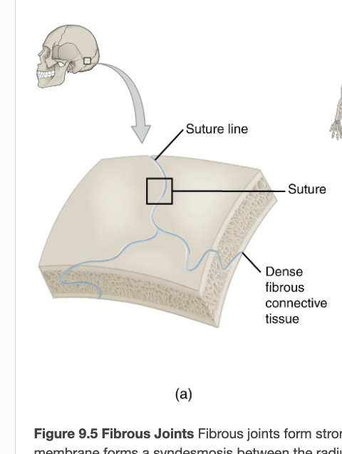 <p>joint where the articulating areas of the adjacent bones are connected by fibrous connective tissue</p><p>Examples: suture</p>
