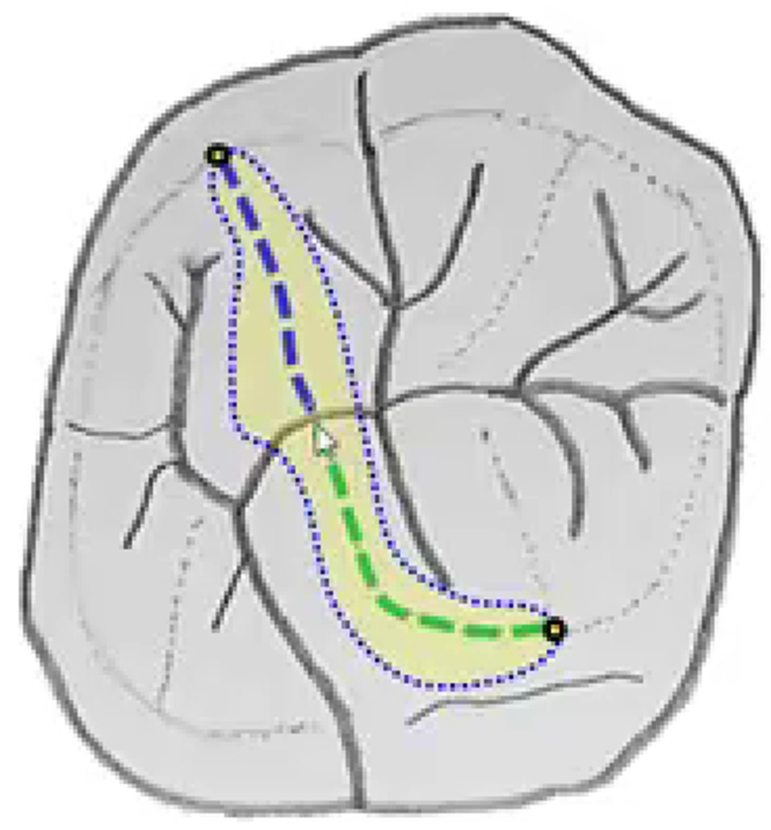 <p>What type of ridge are present on maxillary molars?</p>