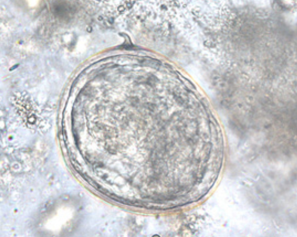 <p>What parasite is this?</p>