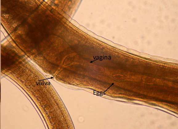 <p><span>Trichuris trichiura (whip worm) adult female</span></p>