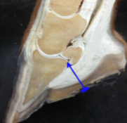 <p>If a nail sticks near the navicular region, what structure is affected?</p>