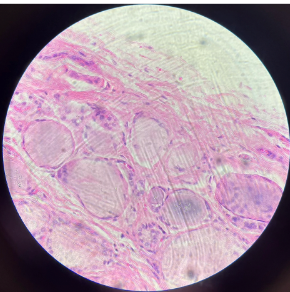 <p>What kind of tissue is this</p>