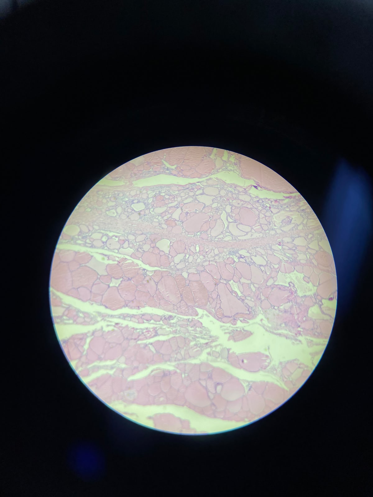 <p>Que Lâmina é essa? cite caracteristicas dela</p>
