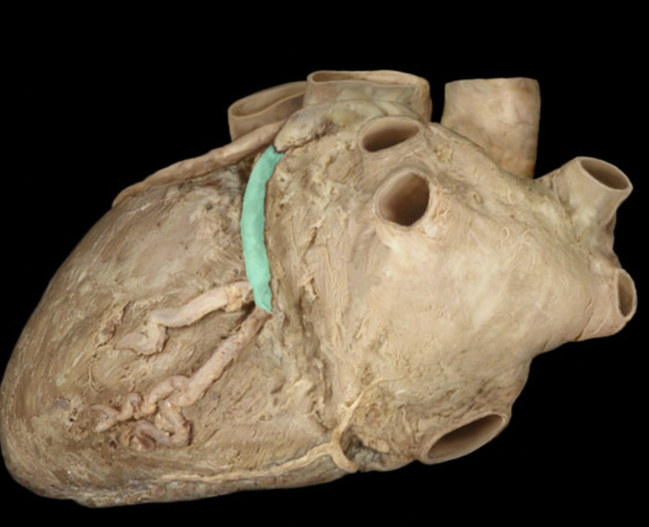 <p>Identify the feature of the left coronary artery</p>