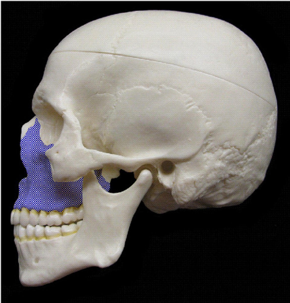 <p>ID highlighted bone</p>