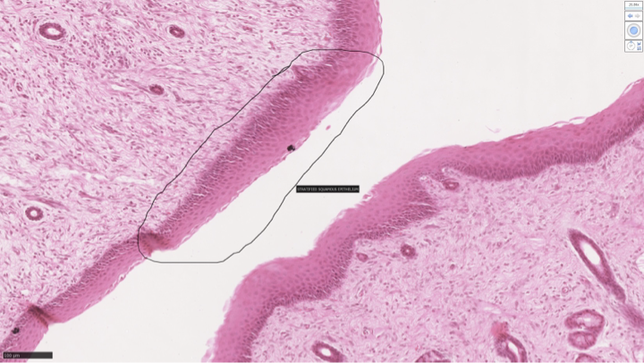 <p>stratified squamous non-keratinized</p>