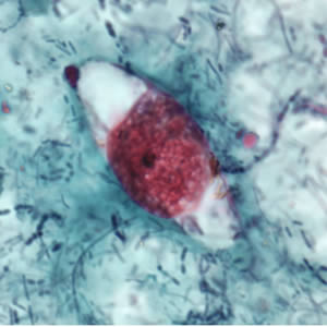 <p>Pink/red/purple oocysts<br>blue-green background<br>Typical ellipsoidal shape</p>