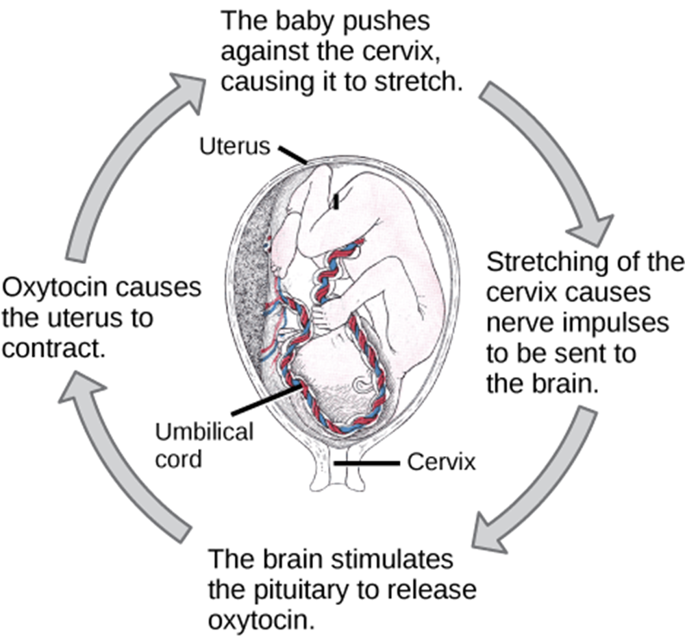 <p><strong>labor contractions</strong></p><ul><li><p>begins ~30min apart</p></li><li><p>strongest in ___, weaker near ___: pushes fetus downwards</p></li><li><p>oxytocin</p><ul><li><p>stimulates ___</p></li><li><p>stimulates ___</p></li></ul></li><li><p>positive feedback mechanism</p><ul><li><p>uterine ___</p></li><li><p>neuroendocrine reflex: ___</p></li><li><p>oxytocin induces ___</p></li></ul></li></ul><p></p>
