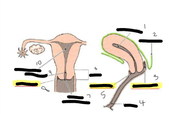 <p>Lable this image?</p>