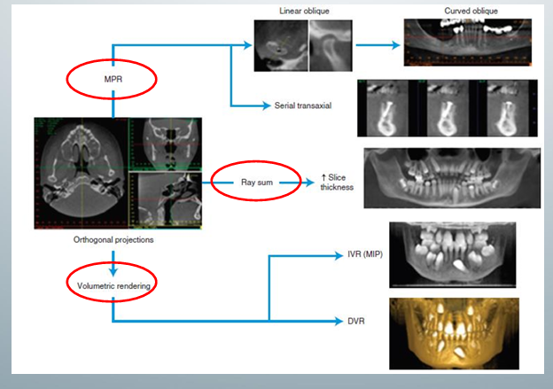 <p>-3 basic format options: multiplanar reformation, ray sum, volumetric rendering</p>