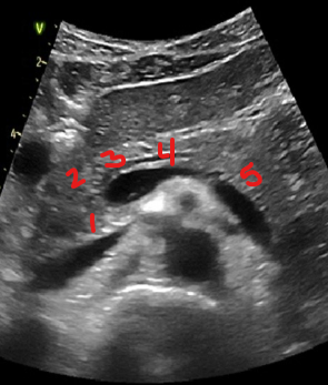 <p>Identify this image. </p>