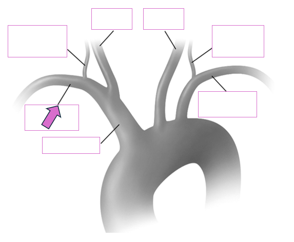 <p>Based on the indicated area, identify this vessel</p>