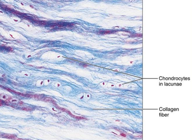 <p>What type of tissue is this?</p>