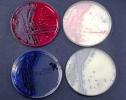<p>Selectief </p><ul><li><p>Selectieve stoffen: antibiotica en hoge zoutconcentratie + chromogeen substraat </p></li><li><p>Groei van: MRSA </p></li></ul><p></p>