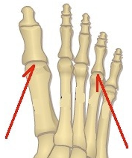 <p>What are these joints?</p>