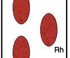 <p>What is the blood type indicated by the results in the right tray?</p>