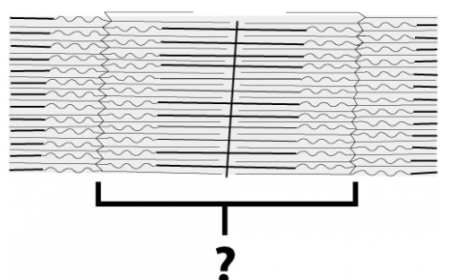 <p>This structure, the actual contractile unit of muscle, is known as a ______. It is also called the functional unit of he muscle.</p>