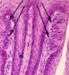 <p>what are arrows pointing to (tongue)</p>