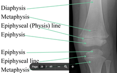 <p>epiphysis</p>
