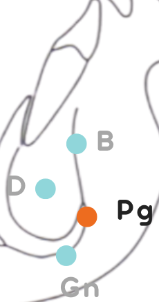 <p>Punto Pg</p>